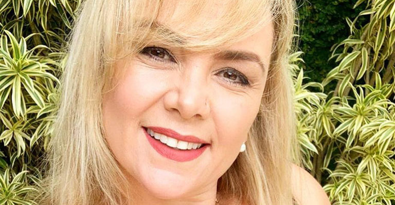 Ex Paquita Ana Paula Almeida Mostra Antes E Depois De Perder 14 Quilos