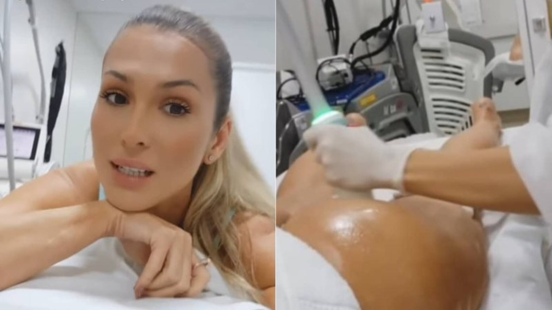 Lívia Andrade empina o bumbum ao mostrar tratamento estético no local