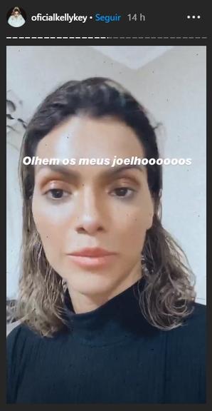 Kelly Key faz apelo ao mostrar joelhos roxos nas redes sociais 