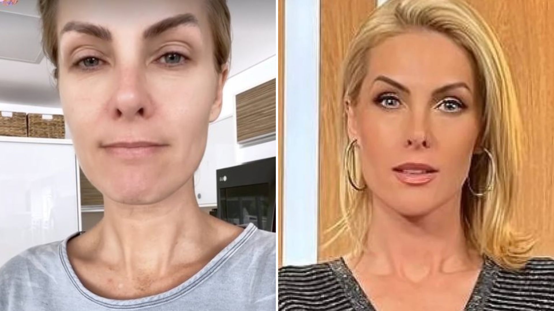 Ana Hickmann Volta às Redes Sociais Após Agressão Do Marido Vou Lutar Pela Minha Vida 4651