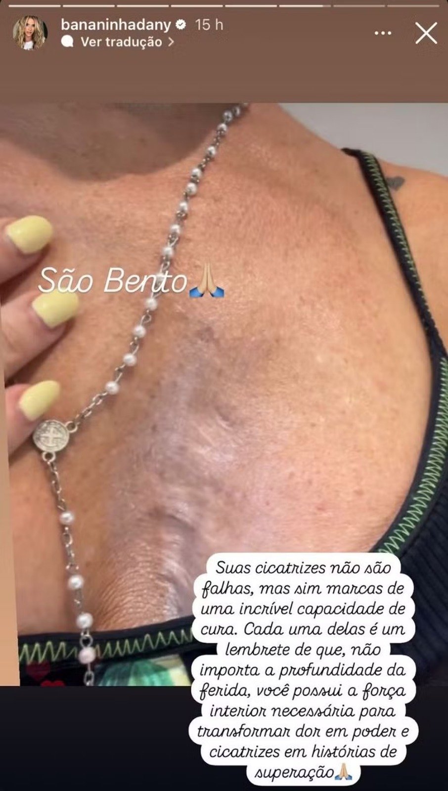 Dany Bananinha (Reprodução/Instagram)